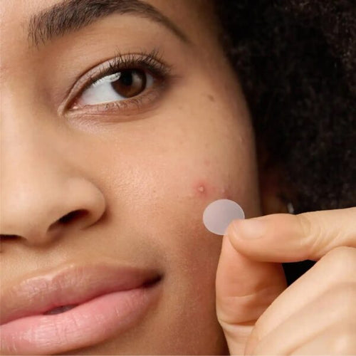 Pimple Patches – 300 Count